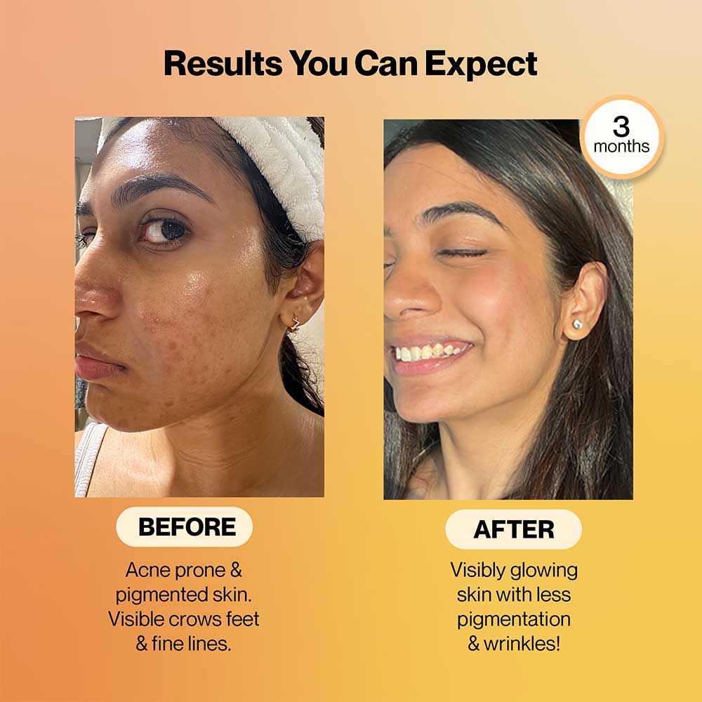 6 - Setu Skin: Renew Fizz & Skin: Youthful Combo,  Orange & Peach Mango  2 Piece(s)/Pack 
