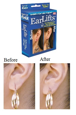 EarLift Invisible Ear Lobe Support Solution