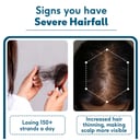 3 - HK Vitals Female Hair Fall Solution,  Severe