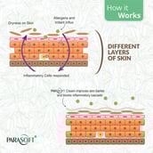 3 - Parasoft Cream for Dry Skin Paraben Free with Added Goodness of Aloe Vera,  500 g  Dry skin 