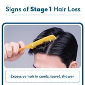 4 - HealthKart HK Vitals Hairfall Solution, STAGE 1