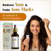 2 - myUpchar Ayurveda Face Serum, 50 ml Reduces Acne & Blemishes